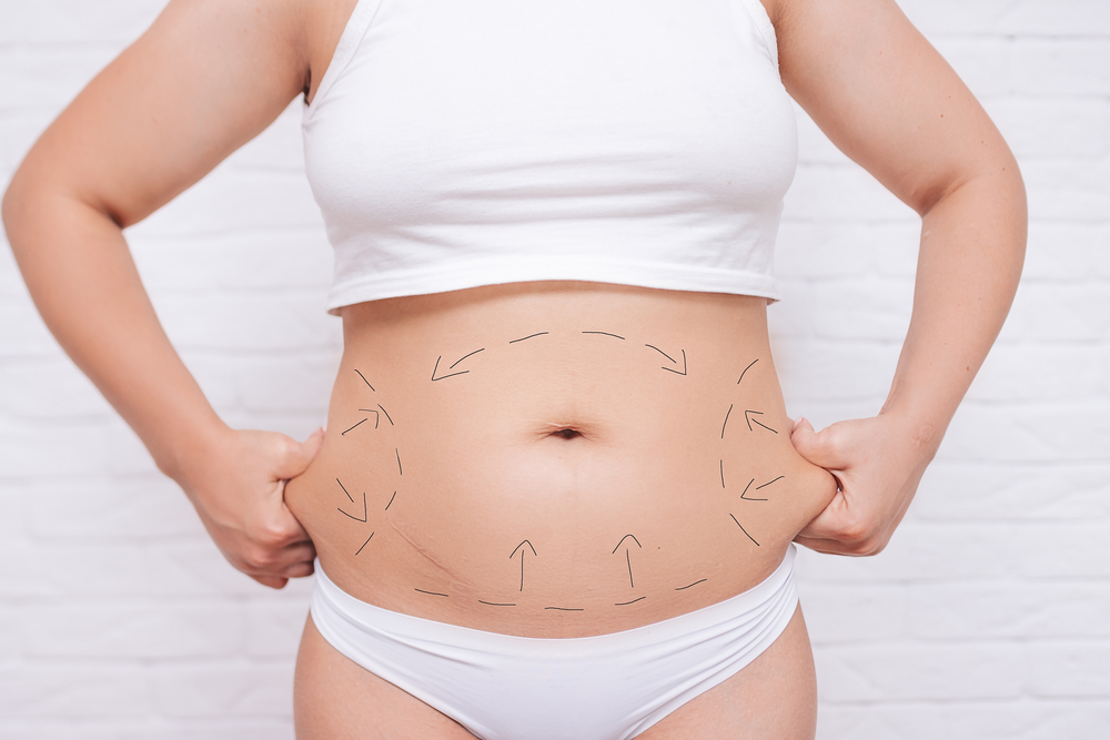 Body Contouring: How to Preserve Your Results Over Time | Perfect Skin Center